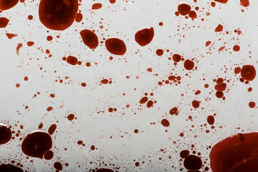 blood-splatter